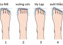 Các loại bàn chân và cách chọn giày dép phù hợp dáng bàn chân